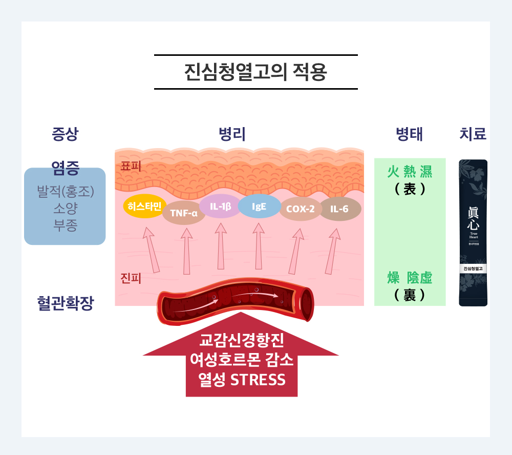 진심청열고 상세 이미지 2